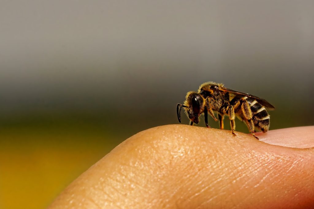 piqûre d'abeille